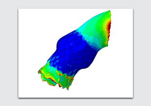 AI Engine in Silico Trials: Aortic Graft Stent Demonstrator